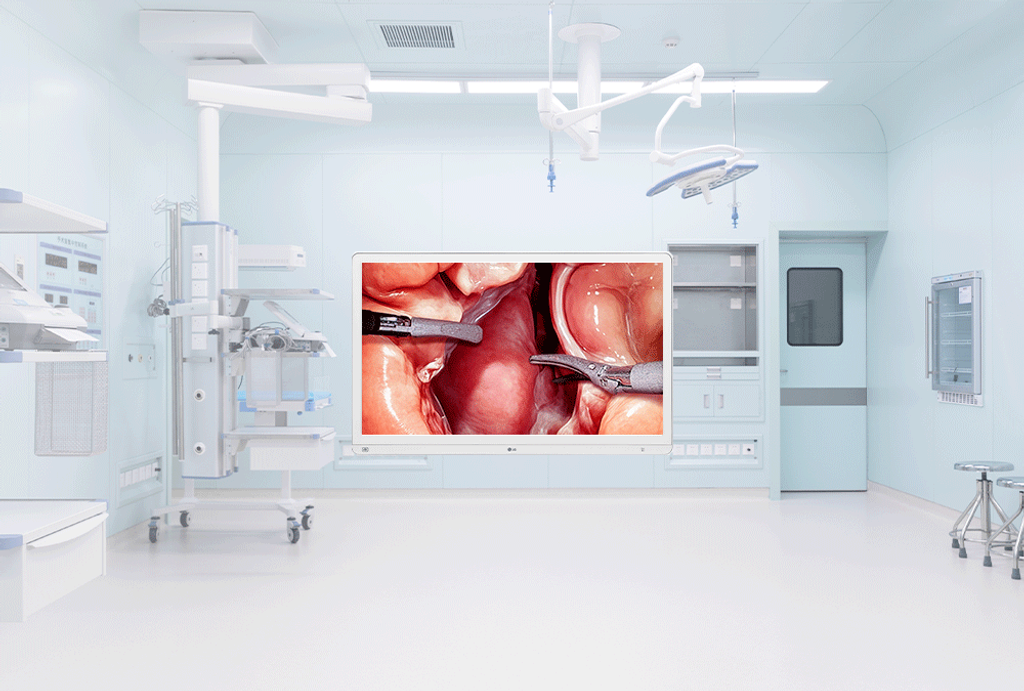 LG Surgical Monitor 32HS710S – 4K, 95% DCI-P3, HDR, Mirror Mode i Clone Screen. Wygodne funkcje dla zespołów operacyjnych i szkoleń.