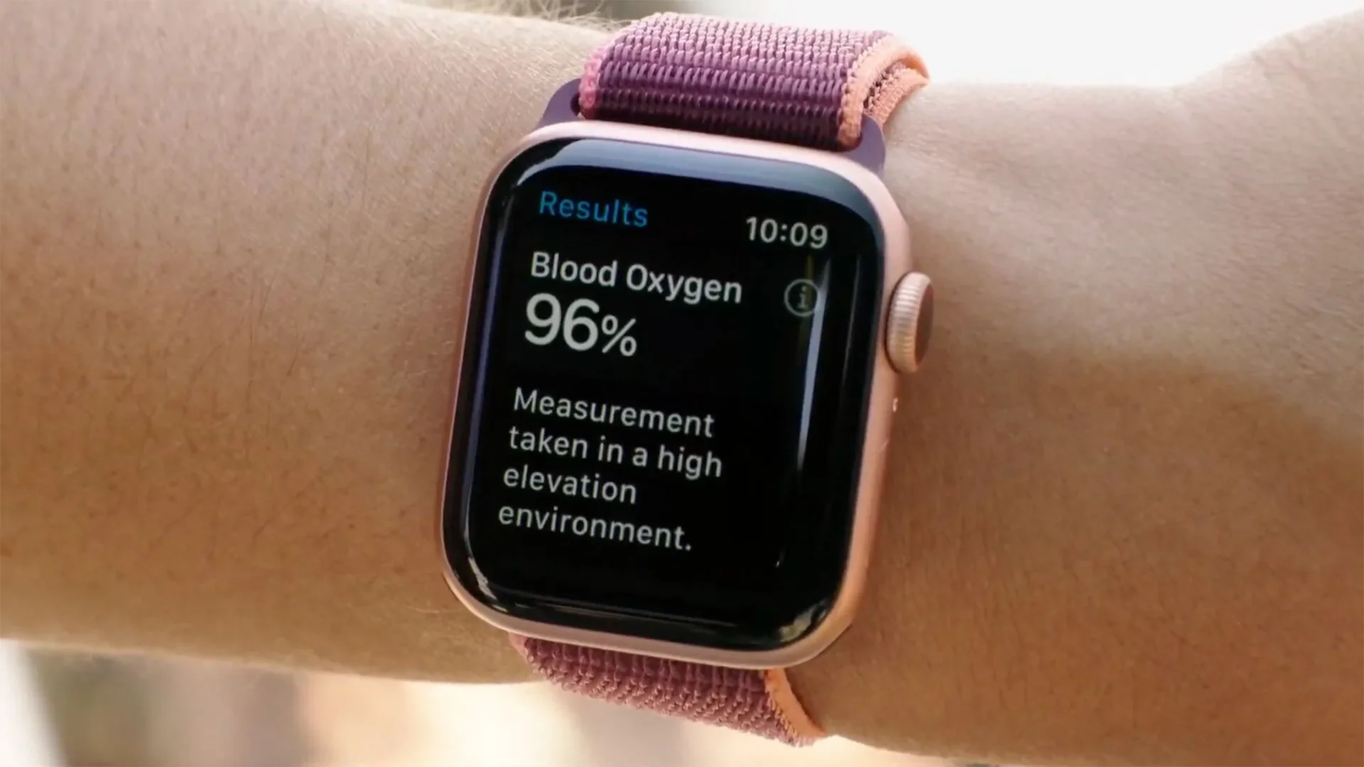 Masimo versus Apple: the patent dispute over the Apple Watch goes to court with the involvement of the American customs office.